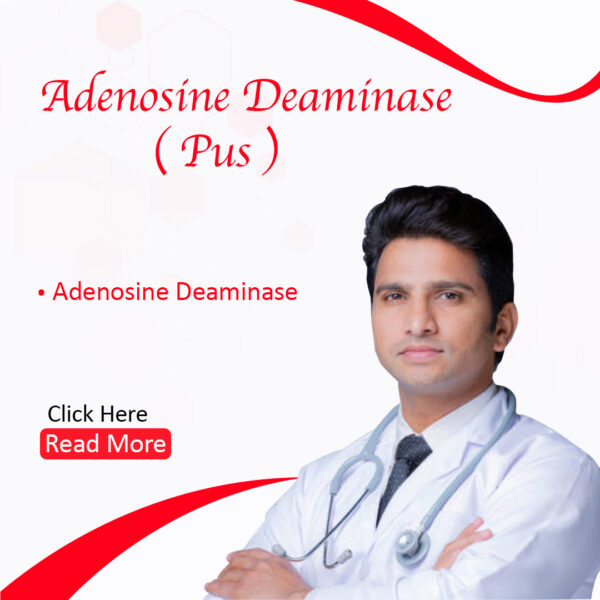 Adenosine Deaminase (ADA) (Pus)