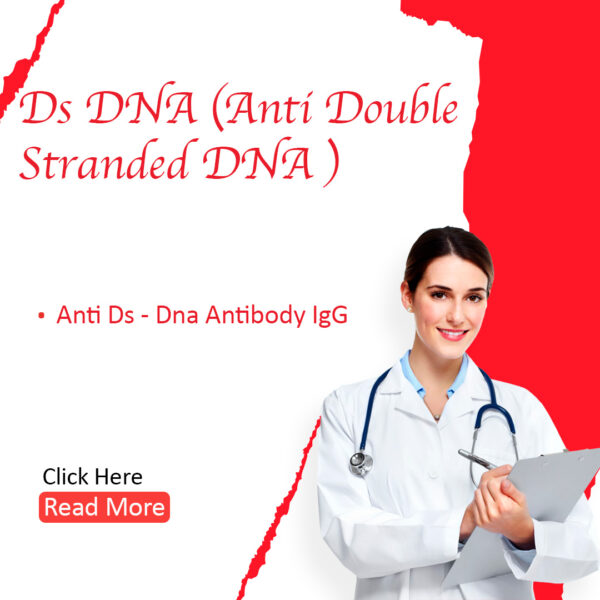 dsDNA (Anti Double Stranded DNA)