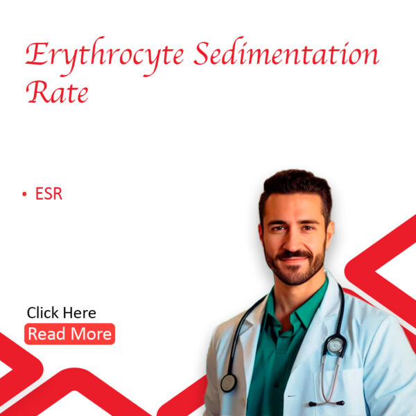 Erythrocyte Sedimentation Rate (ESR)