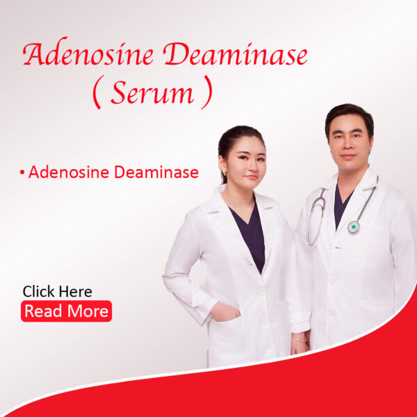 Adenosine Deaminase (ADA) (Serum)