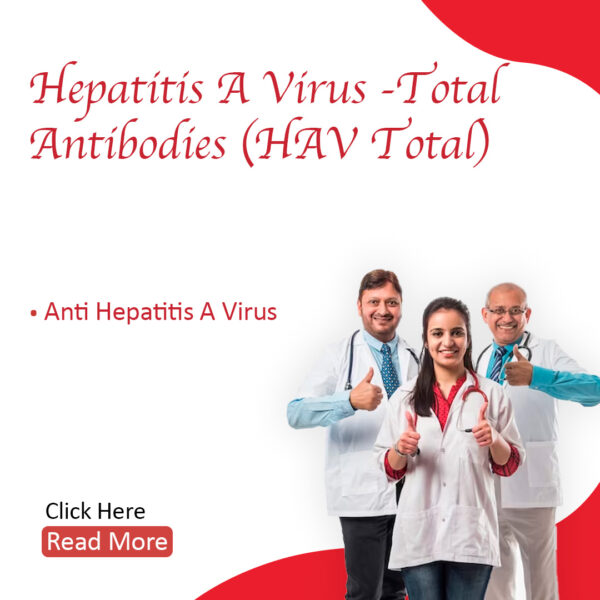 Hepatitis A virus – Total Antibodies (HAV- Total)