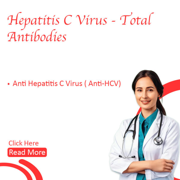 Hepatitis C virus – Total Antibodies (HCV)