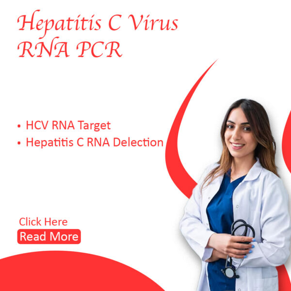 Hepatitis C Virus RNA PCR (Quantitative)