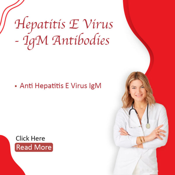 Hepatitis E virus –IgM Antibodies (HEV IgM)