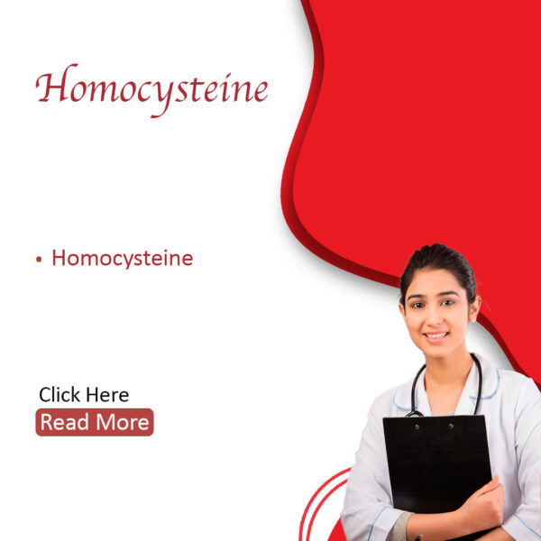 Homocysteine