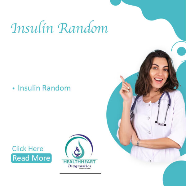 Insulin Random