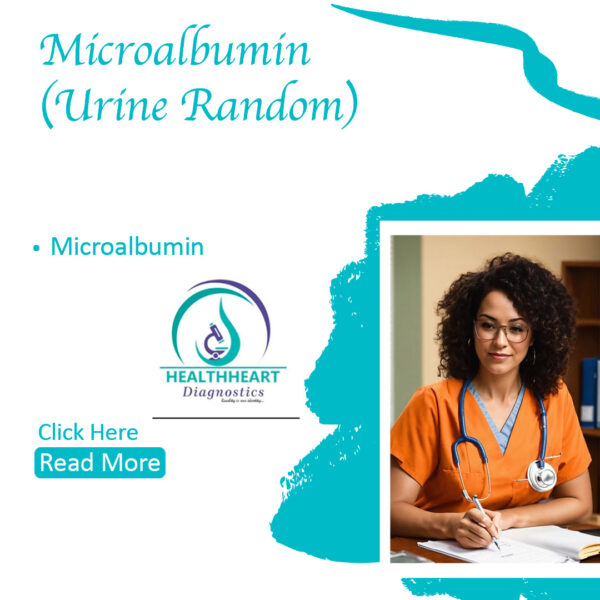 Microalbumin (Urin Random)