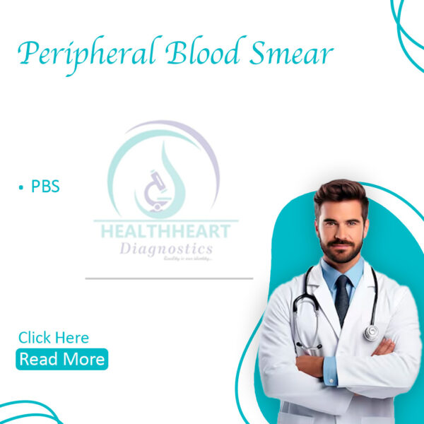 Peripheral Blood Smear (PBS O R PBF)