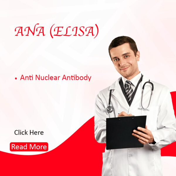 ANA (Anti Nuclear Antibodies) ELISA