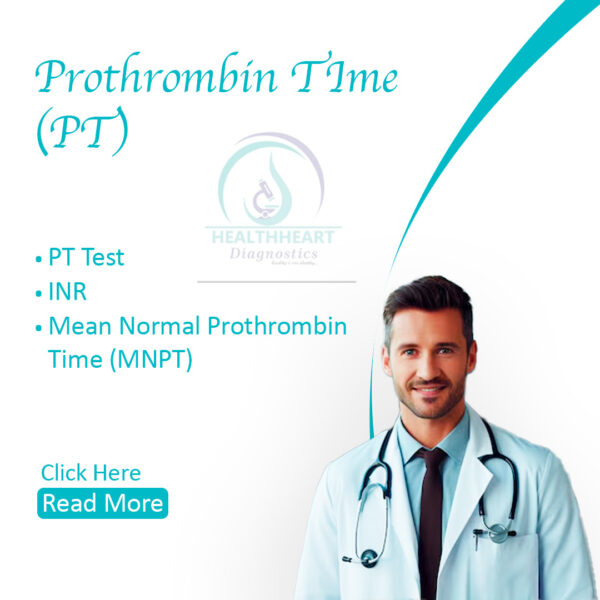 Prothrombin Time (PT)