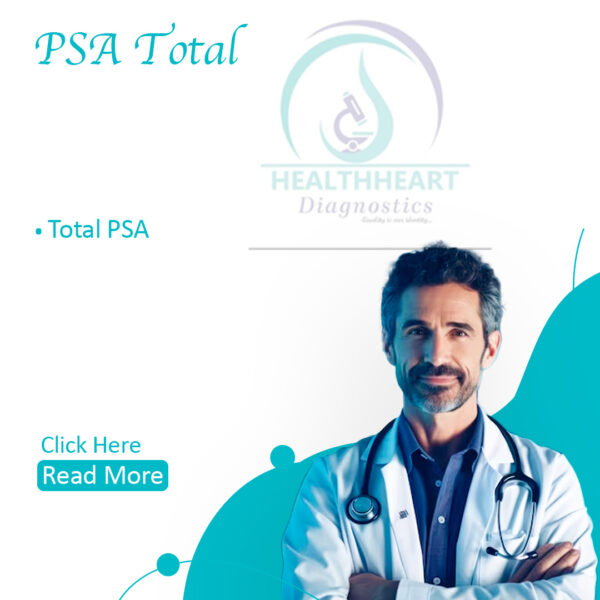 PSA- Total (Prostate Specific Antigen