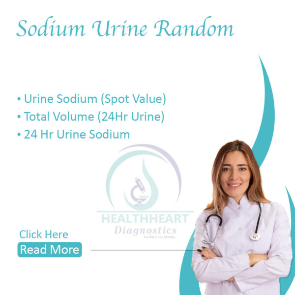 Sodium Urine Random