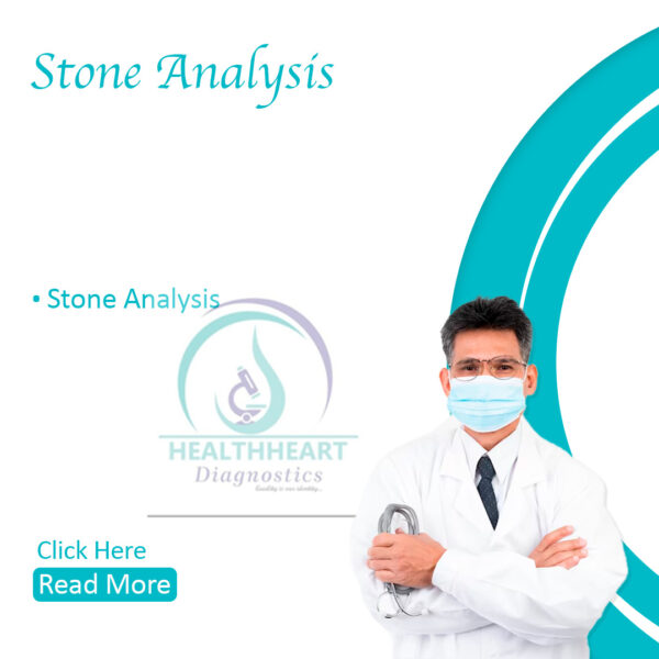 Stone Analysis