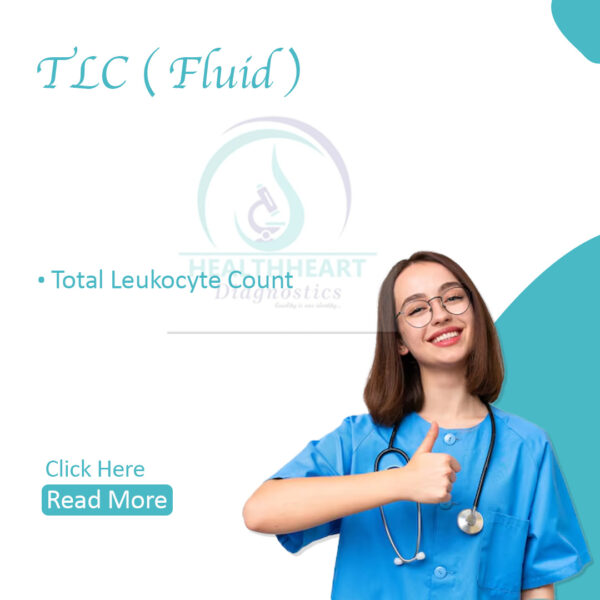 TLC (Fluid)