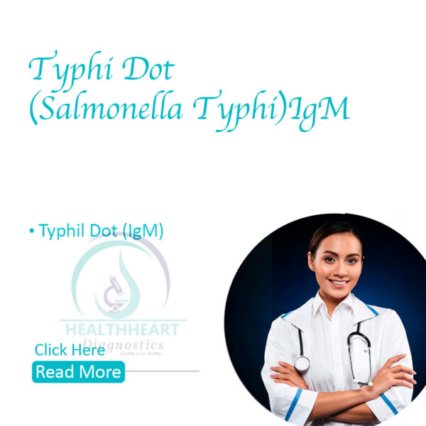 Typhidot (Salmonella Typhi) IgM