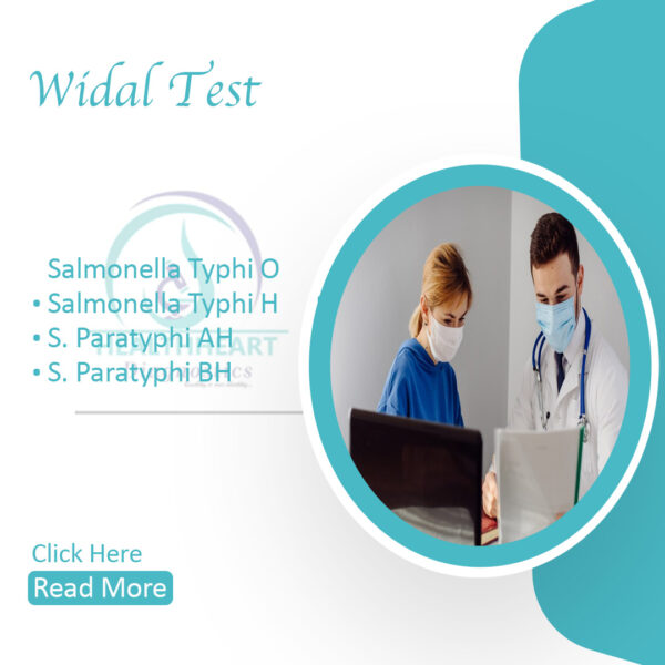 Widal Test (Slide Test)