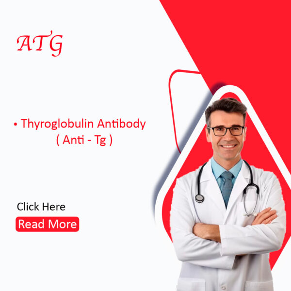 ATG (Antithyroglobulin Antibodies)