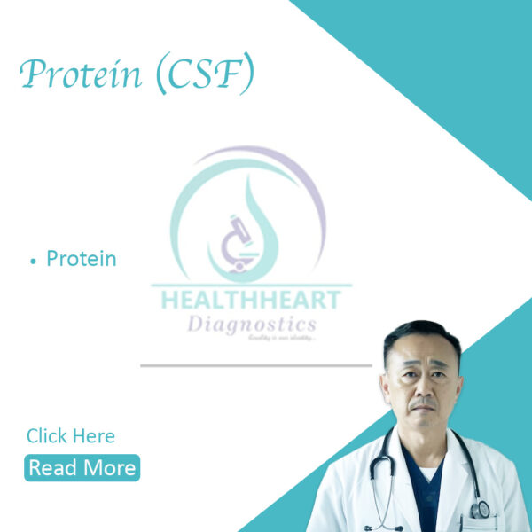 Protein (CSF)