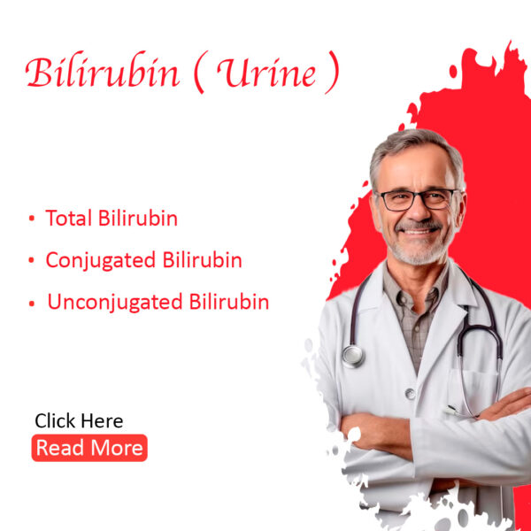 Bilirubin Urine