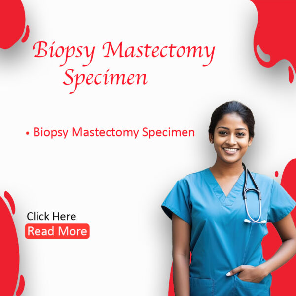 Biopsy Mastectomy Specimen