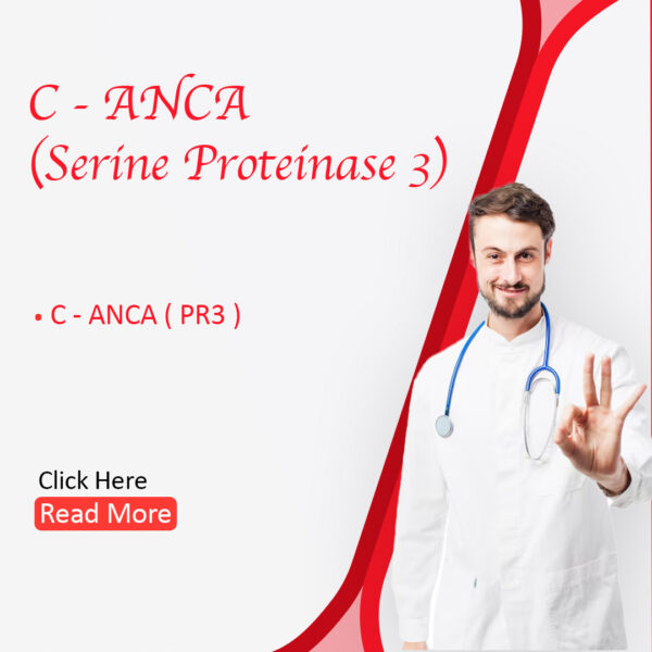 C-ANCA (Serine Proteinase 3)