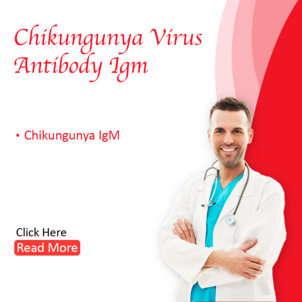 Chikungunya Virus Antibody, IgM