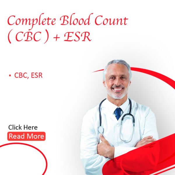 Complete Blood Count (CBC)  +ESR