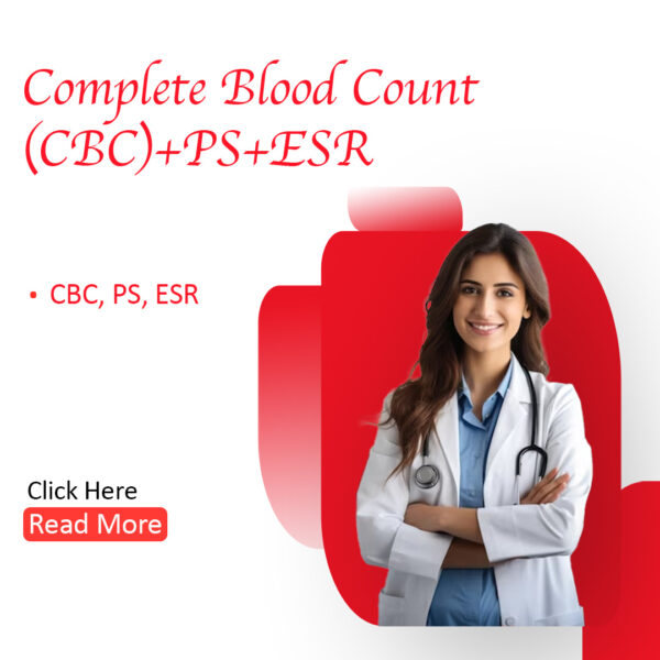 Complete Blood Count (CBC)  +PS+ESR