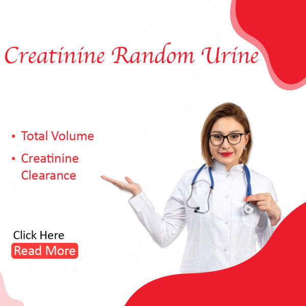 Creatinine Random Urine