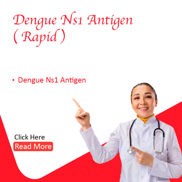 Dengue Ns 1 Antigen (Rapid)